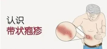 什么人容易得蛇缠腰是什么原因引起的